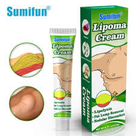 Lipoma Herbal Cream